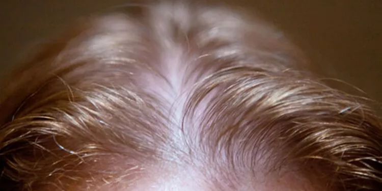 incelmiş saçlara quantum etkisi