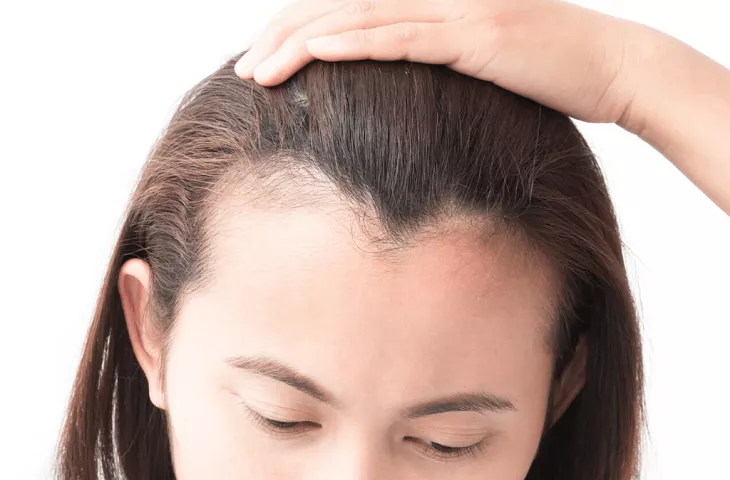 Kadınlarda Saç Ekimi Nasıl Gerçekleşir?