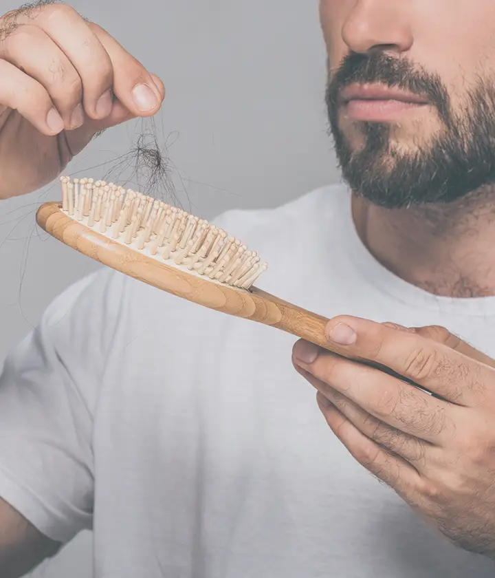 Erkek Tipi Saç Dökülmesi Nasıl Anlaşılır? Ne İyi Gelir?